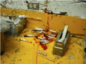 autoclave explosion detail, blood